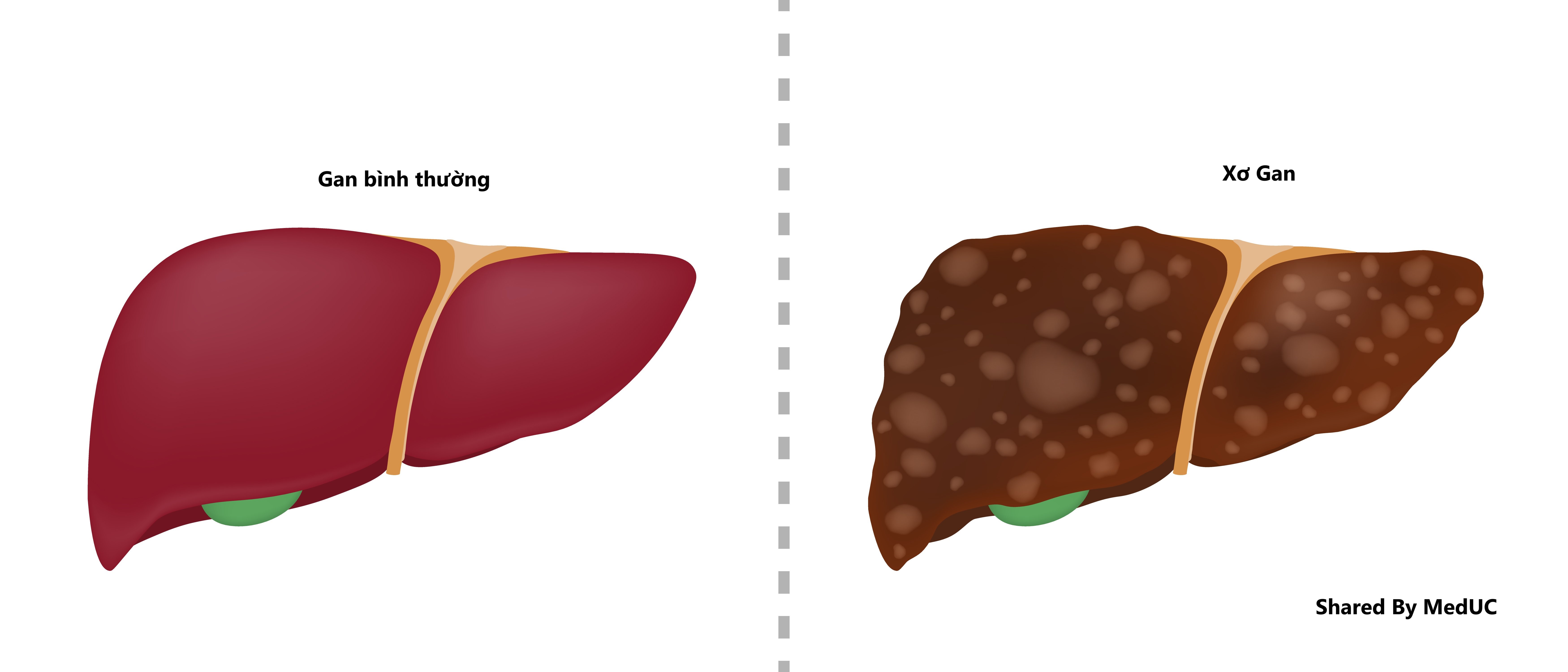 giai-phau-he tinh-mach-cua