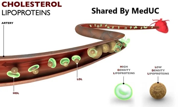 lipoprotein-chuc-nang-bao-ve-trai-tim-va-vai-tro-trong-dieu-tri-tim-mach