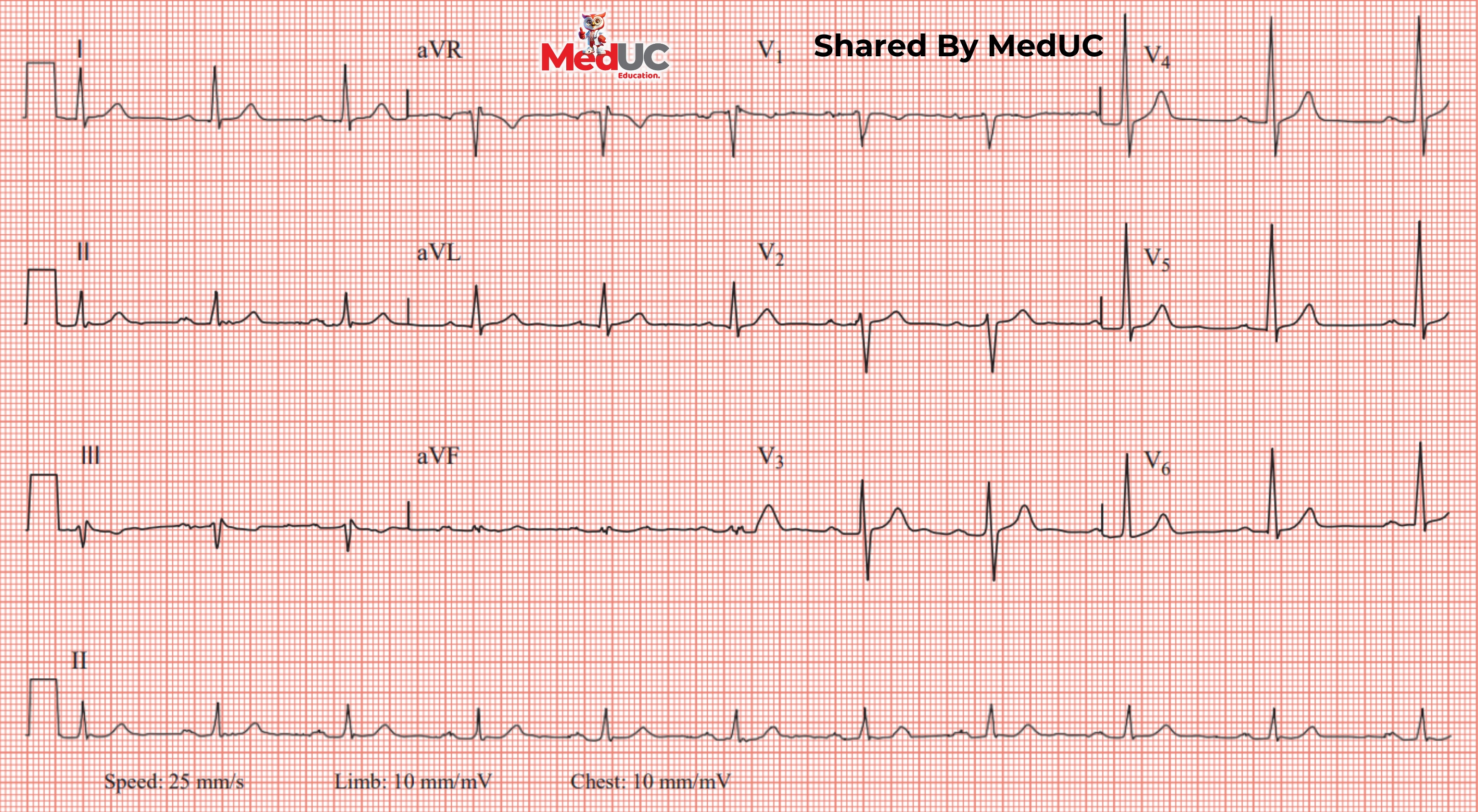 tiet-lo-bi-kip-hoc-dien-tam-do-hieu-qua-de-nang-cao-ky-nang-phan-tich-ecg