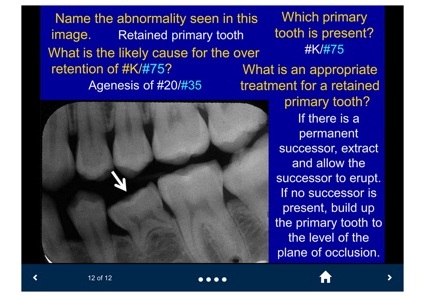 bi-kip-hoc-tot-voi-5-apps-huu-ich-cho-sinh-vien-rang-ham-mat