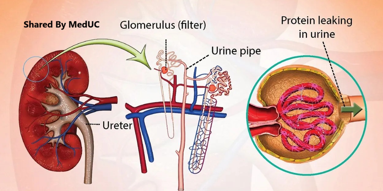 cac-benh-ly-than-pho-bien-ma-di-lam-sang-khoa-nao-cung-gap