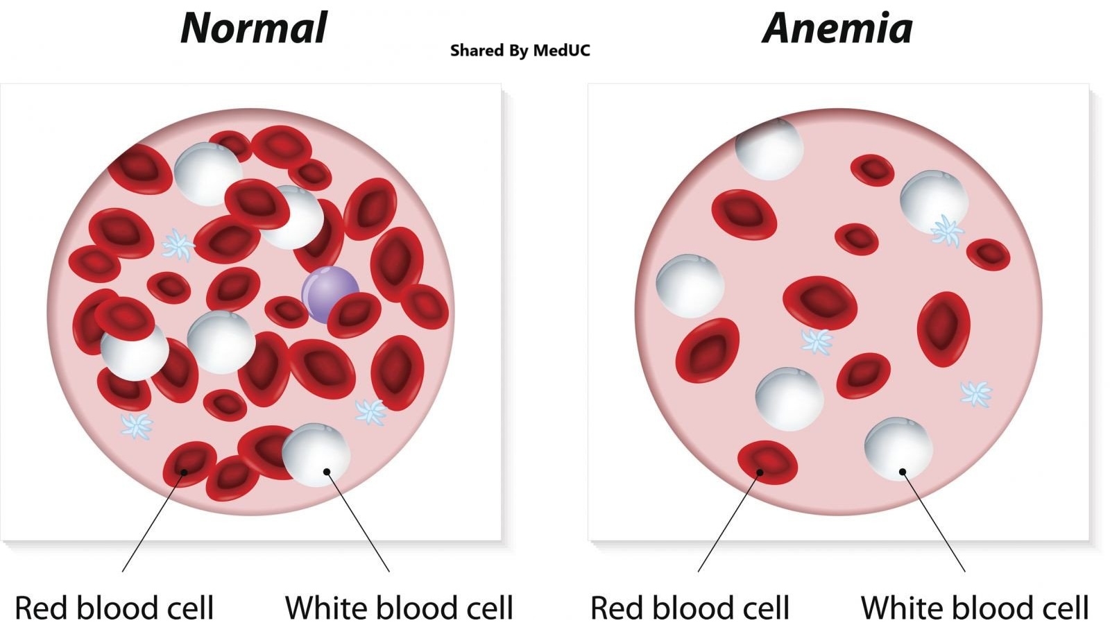 cach-tiep-can-benh-nhan-thieu-mau-don-gian-cho-sinh-vien-y-khi-di-lam-sang
