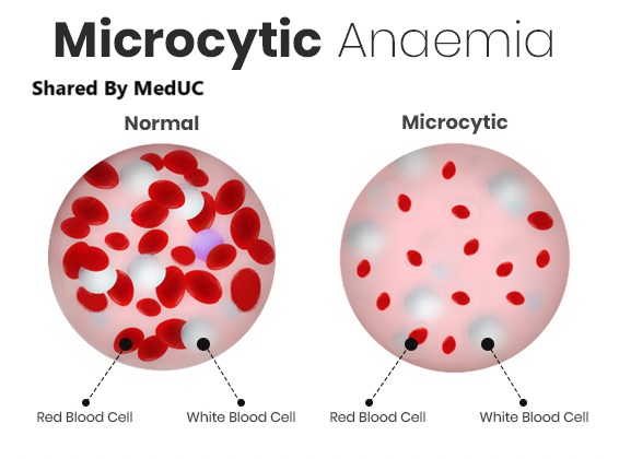 cach-tiep-can-benh-nhan-thieu-mau-don-gian-cho-sinh-vien-y-khi-di-lam-sang