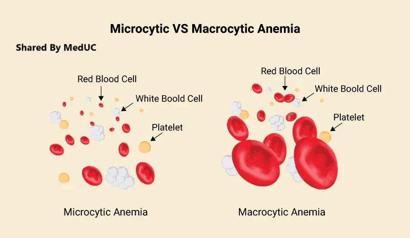 cach-tiep-can-benh-nhan-thieu-mau-don-gian-cho-sinh-vien-y-khi-di-lam-sang