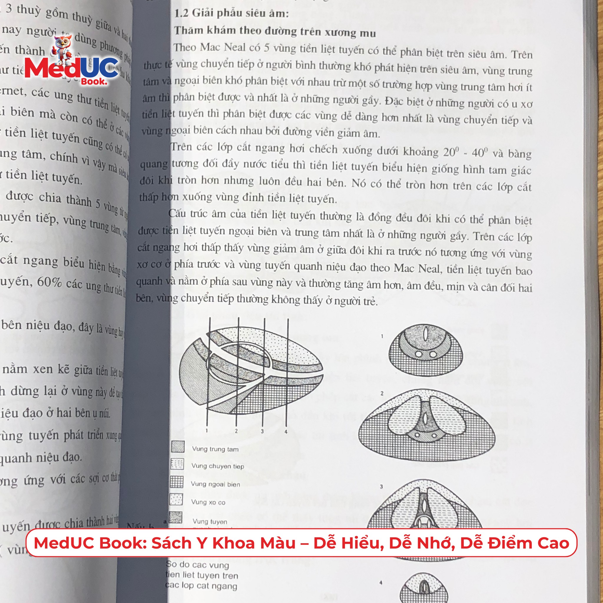 chinh-phuc-ky-nang-sieu-am-voi-sach-sieu-am-tong-quat