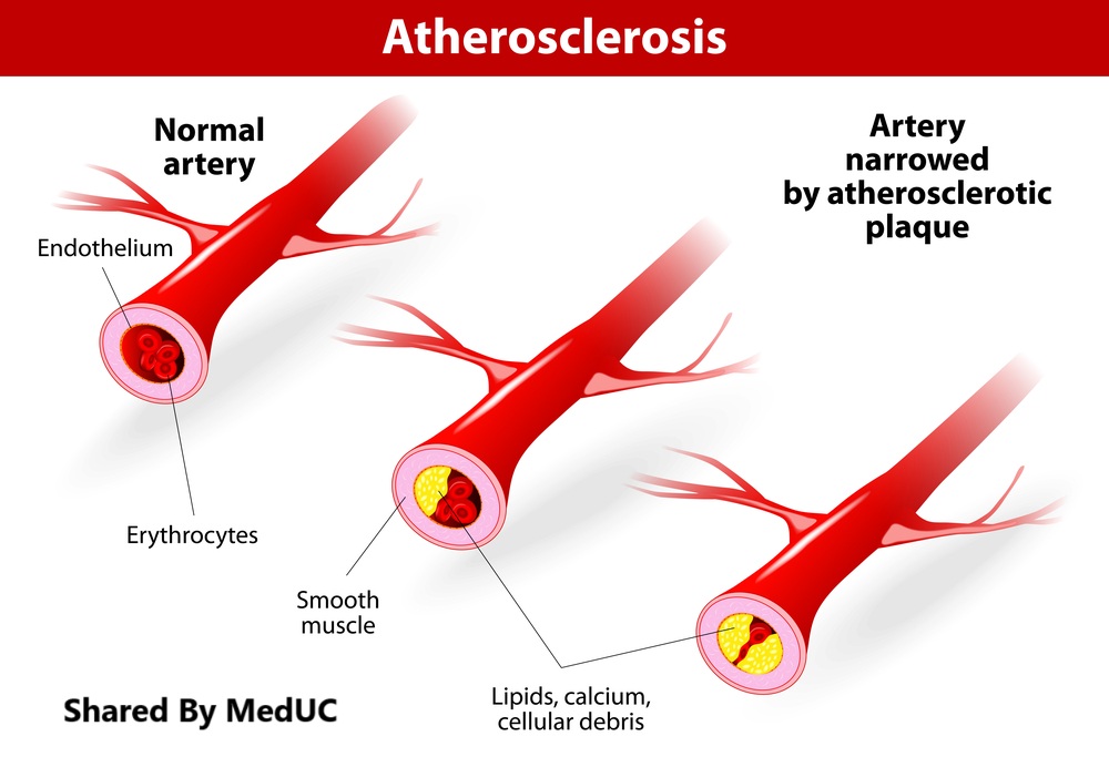 mang-xo-vua-dong-mach-duoi-goc-nhin-hoa-sinh