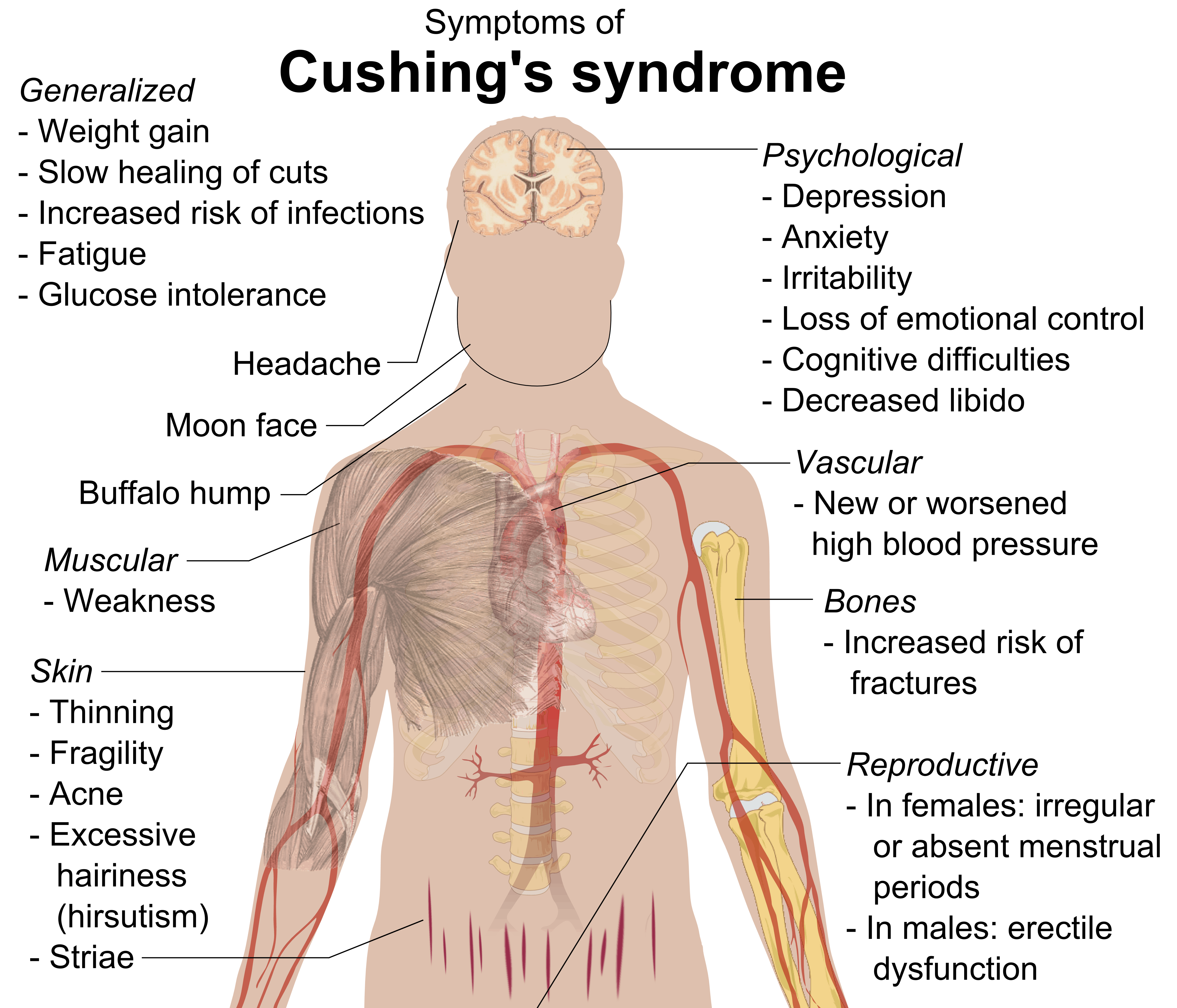 nam-vung-hoi-chung-cushing-chi-trong-5-phut