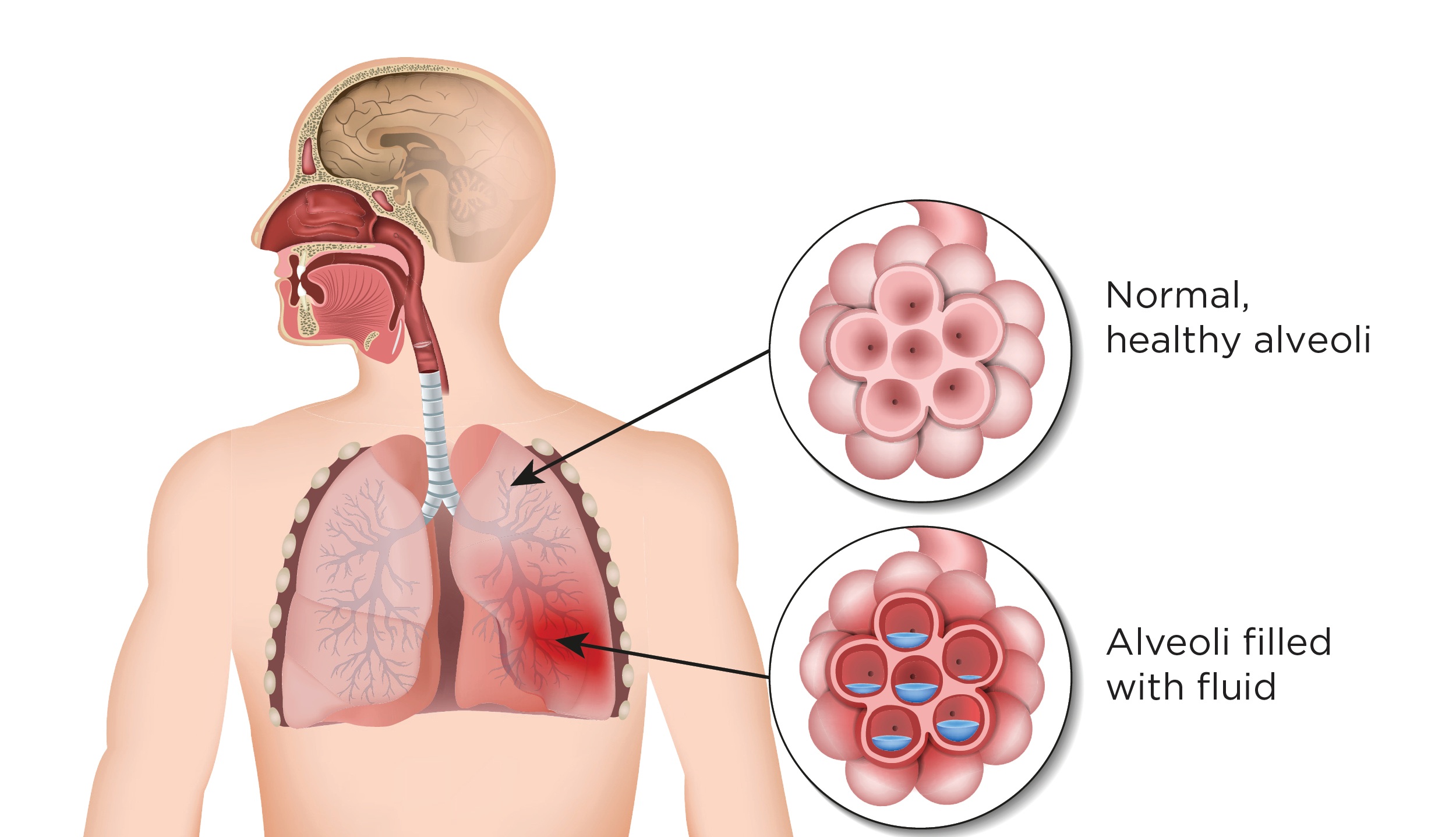dong-dac-phoi-nhung-nguyen-nhan-pho-bien-tren-lam-sang