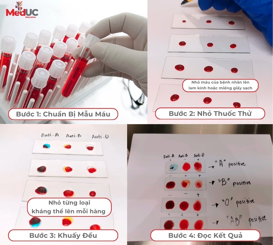 sinh-vien-y-khoa-xac-dinh-nhom-mau-bi-kip-di-lam-sang-hieu-qua