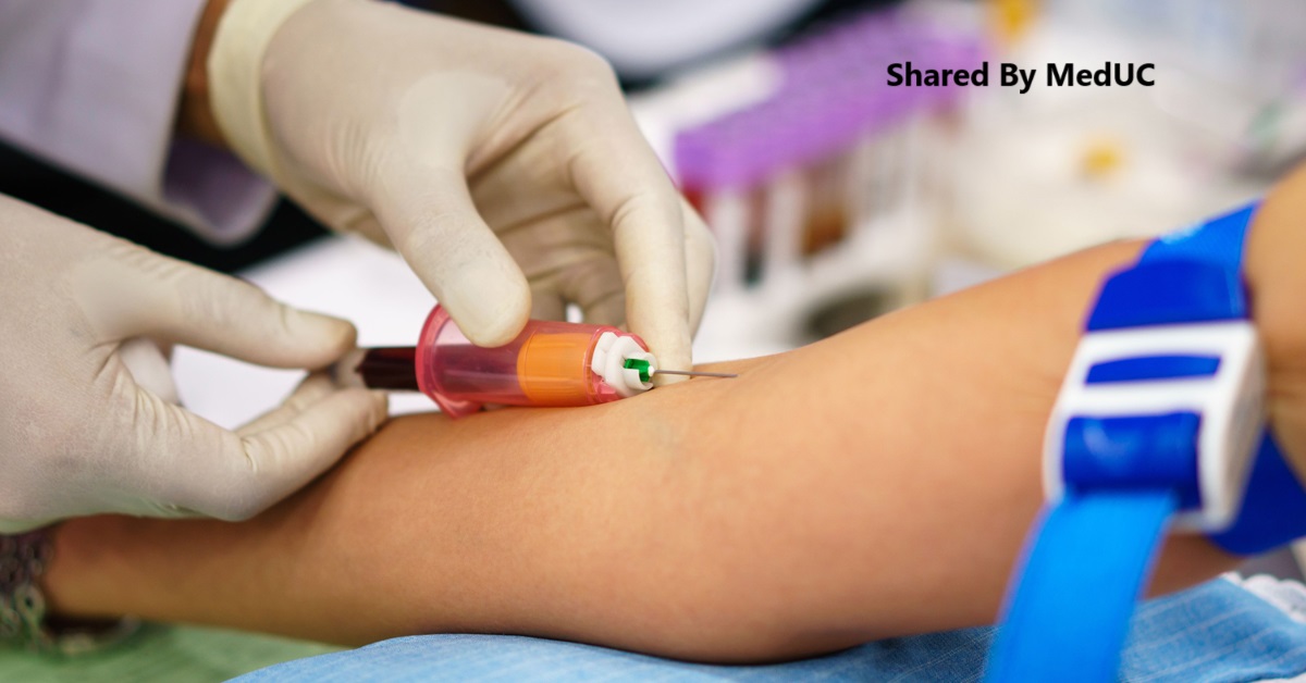 sinh-vien-y-khoa-xac-dinh-nhom-mau-bi-kip-di-lam-sang-hieu-qua