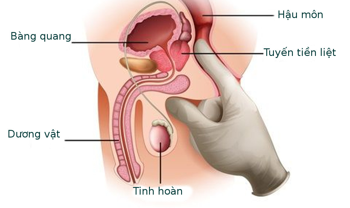 tuyến tiền liệt là gì