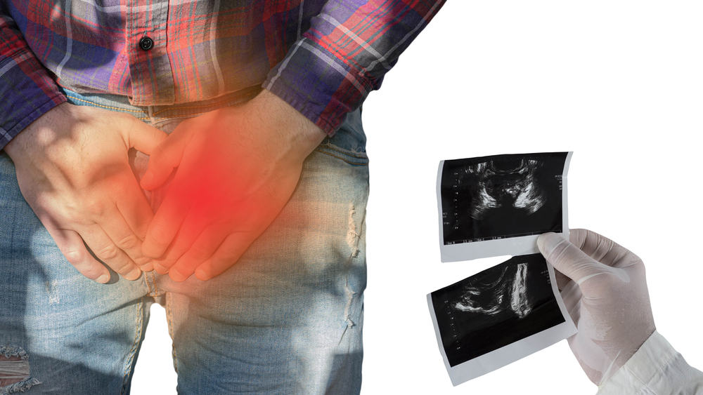 ung thư tuyến tiền liệt