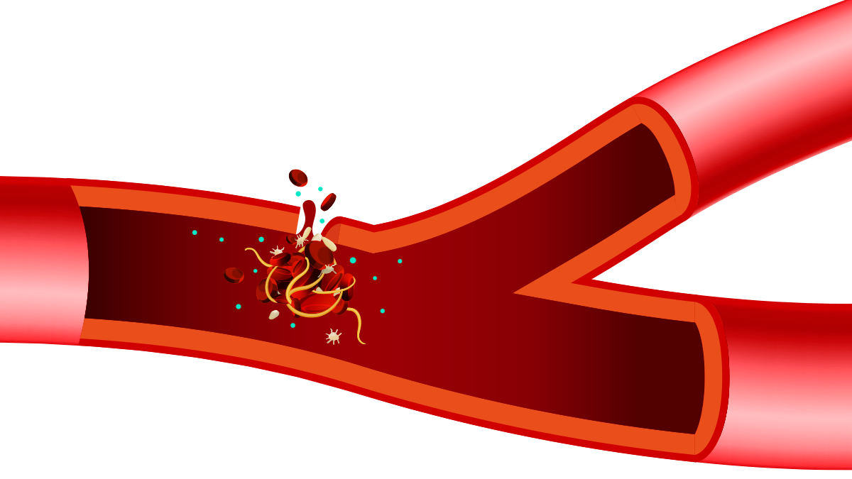 nội mạc v&agrave; lớp dưới nội mạc