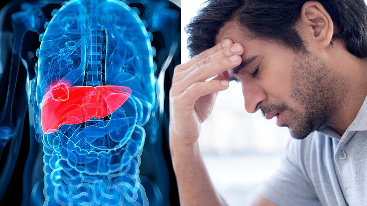 sinh l&yacute; bệnh ở gan