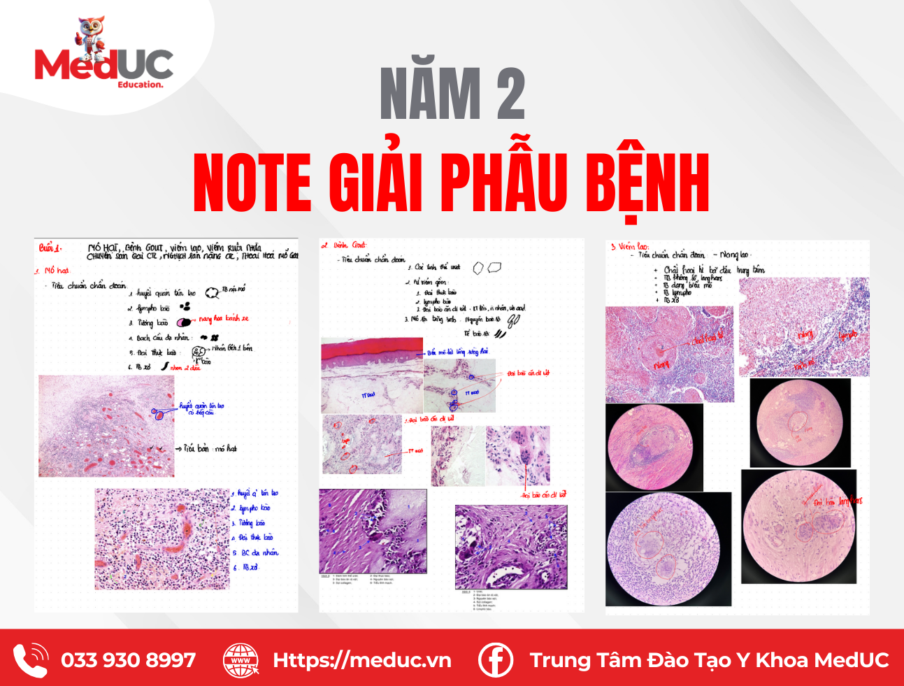 H&igrave;nh Ảnh & Ti&ecirc;u Chuẩn Chẩn Đo&aacute;n