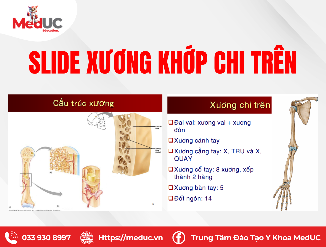 Slide Xương Khớp Chi Tr&ecirc;n