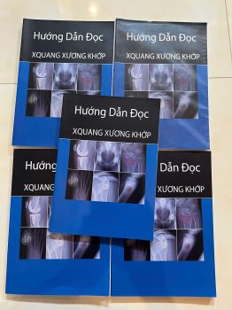 Hướng dẫn đọc XQUANG XƯƠNG KHỚP (IN MÀU)