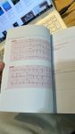 THE ECG IN PRACTICE (In Full Màu, A5) + Khóa học theo sách