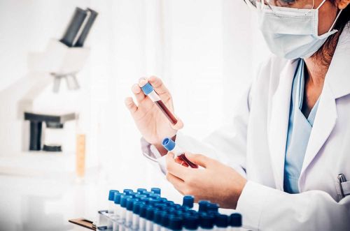 MỘT SỐ CHỈ SỐ HOÁ SINH THƯỜNG GẶP-MedUC.vn