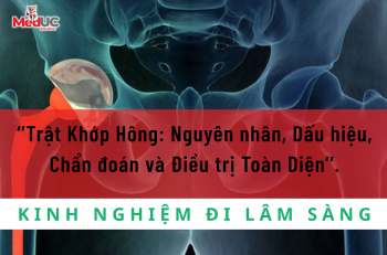 Trật Khớp Hông: Nguyên nhân, Dấu hiệu, Chẩn đoán và Điều trị Toàn Diện