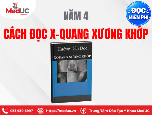 [Năm 4 Chẩn đoán hình ảnh] Hướng Dẫn Đọc X-quang Xương Khớp Miễn Phí