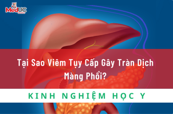 Tại Sao Viêm Tụy Cấp Gây Tràn Dịch Màng Phổi?