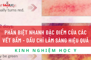 Phân Biệt Vết Bầm Qua Dấu Chỉ Lâm Sàng: Hành Trang Cho Sinh Viên Y Khoa