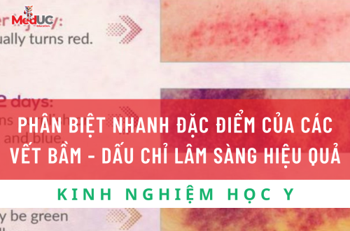 Phân Biệt Vết Bầm Qua Dấu Chỉ Lâm Sàng: Hành Trang Cho Sinh Viên Y Khoa