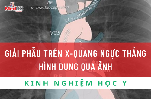 Hiểu Biết Giải Phẫu Trên X-Quang Ngực Thẳng: Chìa Khóa Chẩn Đoán Hình Ảnh Y Khoa