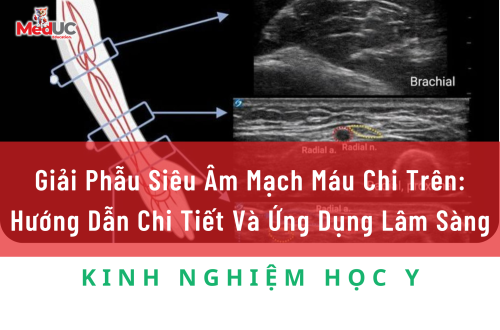Giải Phẫu Siêu Âm Mạch Máu Chi Trên: Hướng Dẫn Chi Tiết Và Ứng Dụng Lâm Sàng