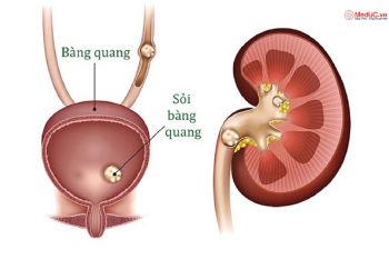 Giải Phẫu Bàng Quang: Vị Trí, Cấu Tạo Và Chức Năng