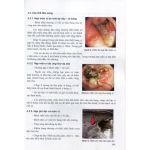 Bài giảng bệnh học ngoại khoa (năm 4, in Full màu) + khóa học theo sách