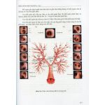 Triệu chứng học nội khoa 2023 (in Màu, 2 tập) + khóa học theo sách