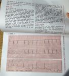 Lâm sàng và biện luận: Điện tâm đồ (in Full màu) + khóa học theo sách