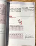 The ECG made easy (in Full màu) + khóa học theo sách